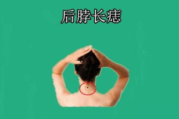 颈部后方的痣类型解析 脖颈后部痣的含义探究