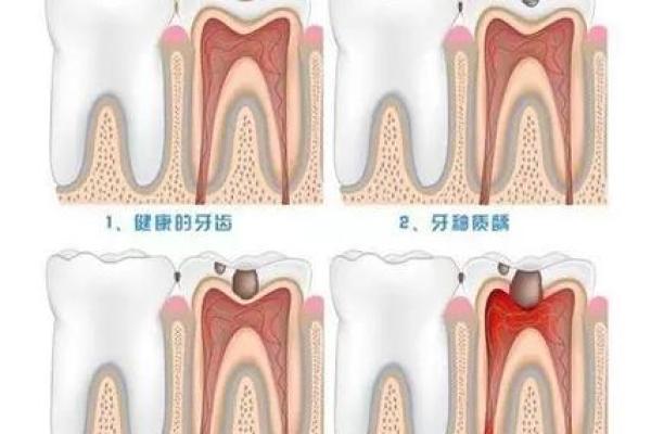 牙齿经常疼和风水有关吗