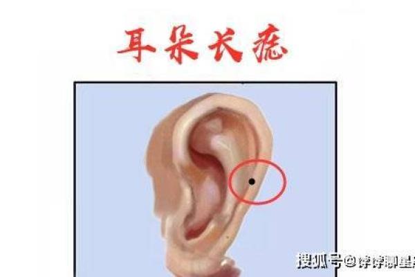 探究耳背痣男子：解析耳背长痣的深层含义