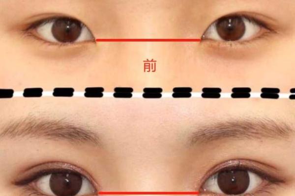 宽眼距面相解析：探讨两眼间距较大者的性格与特质