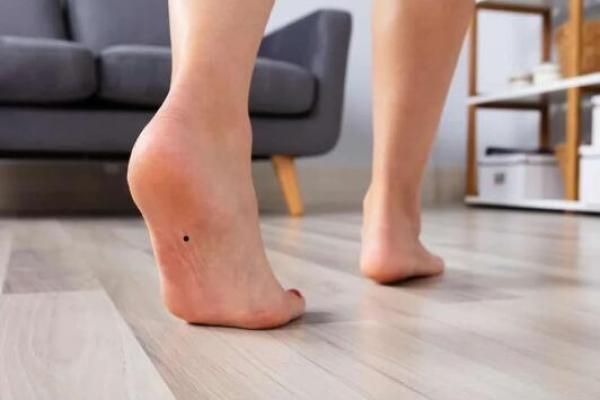 脚部痣的含义探究：脚上的痣代表着什么？