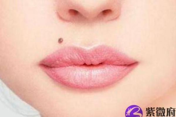 女性胸前桃花痣真相：脖颈痣可能引小人缠身