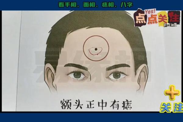 男性额头痣解析：额间痣预示福运伴随终身