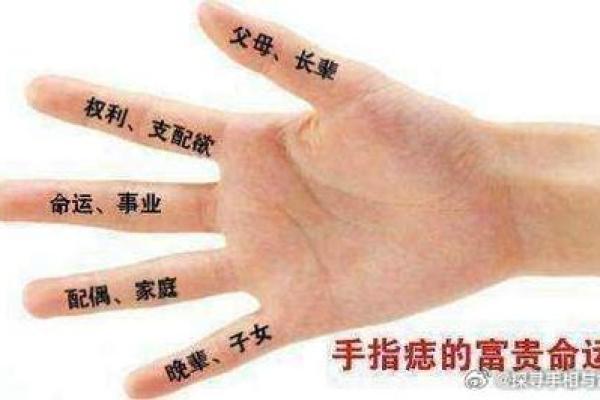 女性右手掌痣解析：掌心痣象征富贵，掌背痣预示尊贵
