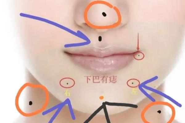 女性下巴中央痣相解析：下巴长痣寓意探讨