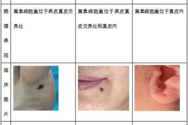 痣的数量与命运关联：印堂痣多预示重大变故